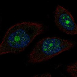 POP1 Polyclonal Antibody:Antibodies, Polyclonal