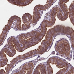 Invitrogen A-Raf Polyclonal Antibody 100 &mu;L; Unconjugated:Antibodies,