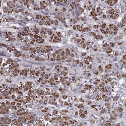 Invitrogen RIM2 Polyclonal Antibody 100 &mu;L; Unconjugated:Antibodies,