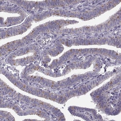 Invitrogen RIM2 Polyclonal Antibody 100 &mu;L; Unconjugated:Antibodies,