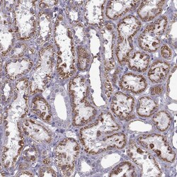 Invitrogen RIM2 Polyclonal Antibody 100 &mu;L; Unconjugated:Antibodies,
