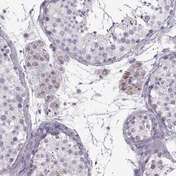 Invitrogen RIM2 Polyclonal Antibody 100 &mu;L; Unconjugated:Antibodies,