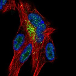 Invitrogen ZNF768 Polyclonal Antibody 100 &mu;L; Unconjugated:Antibodies,
