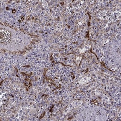 Invitrogen NHERF2 Polyclonal Antibody 100 &mu;L; Unconjugated:Antibodies,