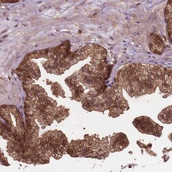 Invitrogen TIP47 Polyclonal Antibody 100 &mu;L; Unconjugated:Antibodies,