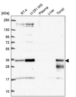 HES1 Polyclonal Antibody, Invitrogen 100 &mu;L; Unconjugated:Antibodies,