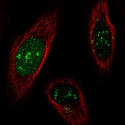 Invitrogen SNAPC1 Polyclonal Antibody 100 &mu;L; Unconjugated:Antibodies,
