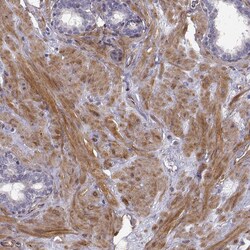 Invitrogen PGM5 Polyclonal Antibody 100 &mu;L; Unconjugated:Antibodies,