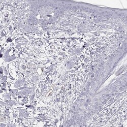 Invitrogen PGM5 Polyclonal Antibody 100 &mu;L; Unconjugated:Antibodies,