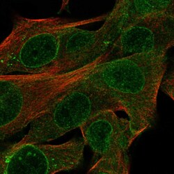 Invitrogen CYTL1 Polyclonal Antibody 100 &mu;L; Unconjugated:Antibodies,