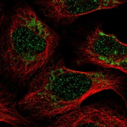 Invitrogen PET100 Polyclonal Antibody 100 &mu;L; Unconjugated:Antibodies,
