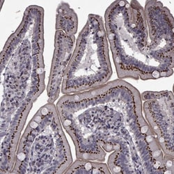 Invitrogen ATP6V1C2 Polyclonal Antibody 100 &mu;L; Unconjugated:Antibodies,