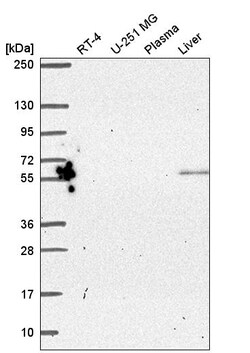 Invitrogen PYROXD2 Polyclonal Antibody 100 &mu;L; Unconjugated:Antibodies,