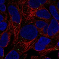 GPR98 Polyclonal Antibody:Antibodies, Polyclonal