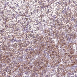 GPR98 Polyclonal Antibody:Antibodies, Polyclonal