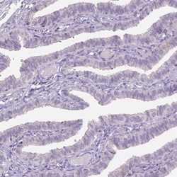GPR98 Polyclonal Antibody:Antibodies, Polyclonal