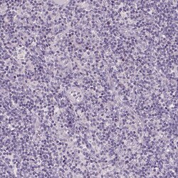GPR98 Polyclonal Antibody:Antibodies, Polyclonal