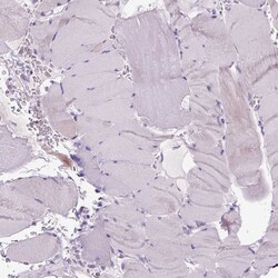 GPR98 Polyclonal Antibody:Antibodies, Polyclonal