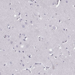 MIP-3 beta Polyclonal Antibody:Antibodies, Polyclonal