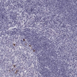 MIP-3 beta Polyclonal Antibody:Antibodies, Polyclonal