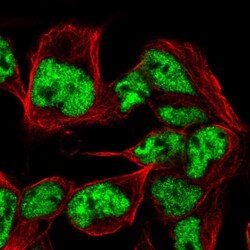 Invitrogen SNRPB Polyclonal Antibody 100 &mu;L; Unconjugated:Antibodies,