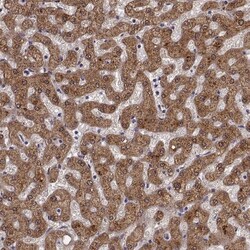 Invitrogen ADH6 Polyclonal Antibody 100 &mu;L | Buy Online | Invitrogen&trade; | Fisher Scientific