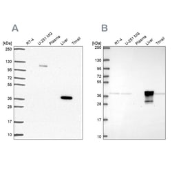 Invitrogen ADH6 Polyclonal Antibody 100 &mu;L | Buy Online | Invitrogen&trade; | Fisher Scientific