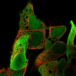 AKR1C1 Polyclonal Antibody:Antibodies, Polyclonal