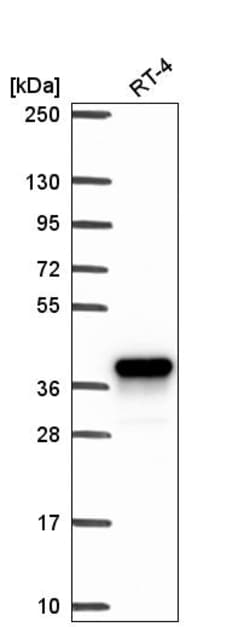 Invitrogen AKR1C1 Polyclonal Antibody 100 &mu;L | Buy Online | Invitrogen&trade; | Fisher Scientific