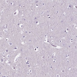 Invitrogen AIM Polyclonal Antibody 100 &mu;L; Unconjugated:Antibodies,