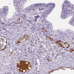 Invitrogen AIM Polyclonal Antibody 100 &mu;L; Unconjugated:Antibodies,