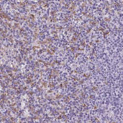 Invitrogen AIM Polyclonal Antibody 100 &mu;L; Unconjugated:Antibodies,