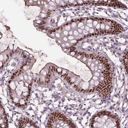 Invitrogen SOX17 Polyclonal Antibody 100 &mu;L; Unconjugated:Antibodies,
