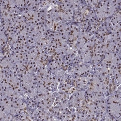 Invitrogen FTO Polyclonal Antibody 100 &mu;L; Unconjugated:Antibodies,