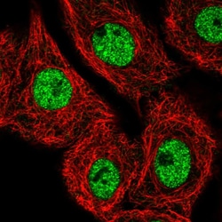 MED25 Polyclonal Antibody:Antibodies, Polyclonal