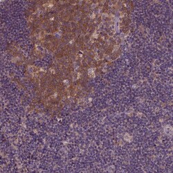 Invitrogen KBTBD8 Polyclonal Antibody 100 &mu;L; Unconjugated:Antibodies,