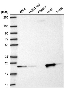 Invitrogen KBTBD8 Polyclonal Antibody 100 &mu;L | Buy Online | Invitrogen&trade; | Fisher Scientific