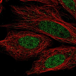 Invitrogen CCDC36 Polyclonal Antibody 100 &mu;L; Unconjugated:Antibodies,