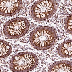 Invitrogen ENTPD6 Polyclonal Antibody 100 &mu;L; Unconjugated:Antibodies,