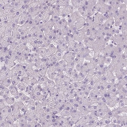 Invitrogen Tau Polyclonal Antibody 100 &mu;L; Unconjugated:Antibodies,