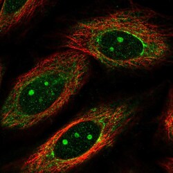 Invitrogen MKP-1 Polyclonal Antibody 100 &mu;L; Unconjugated:Antibodies,