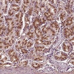 Invitrogen SEC23B Polyclonal Antibody 100 &mu;L; Unconjugated:Antibodies,