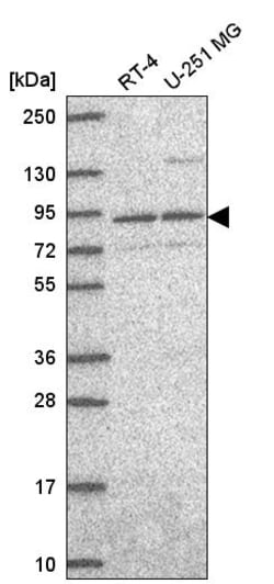 Invitrogen SEC23B Polyclonal Antibody 100 &mu;L; Unconjugated:Antibodies,