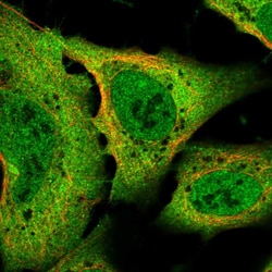 SLC8A1 Polyclonal Antibody:Antibodies, Polyclonal