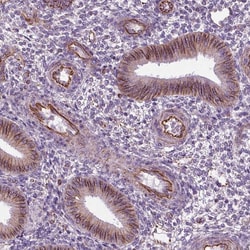 Invitrogen ACER3 Polyclonal Antibody 100 &mu;L; Unconjugated:Antibodies,
