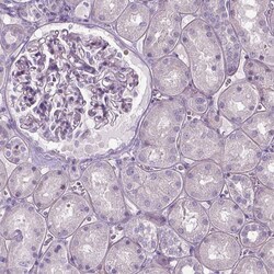 Invitrogen JAK3 Polyclonal Antibody 100 &mu;L; Unconjugated:Antibodies,