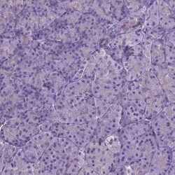 Invitrogen JAK3 Polyclonal Antibody 100 &mu;L; Unconjugated:Antibodies,