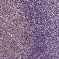 Invitrogen JAK3 Polyclonal Antibody 100 &mu;L; Unconjugated:Antibodies,