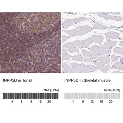 Invitrogen SHIP1 Polyclonal Antibody 100 &mu;L; Unconjugated:Antibodies,