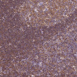 Invitrogen SHIP1 Polyclonal Antibody 100 &mu;L; Unconjugated:Antibodies,